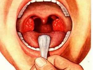 Полоскание горла ребенку при ангине