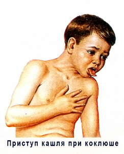 Нервный кашель у детей симптомы