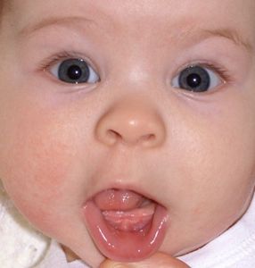 У ребенка насморк режутся зубы